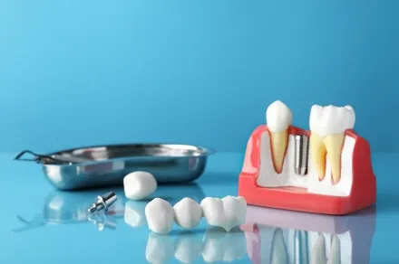 インプラント模型