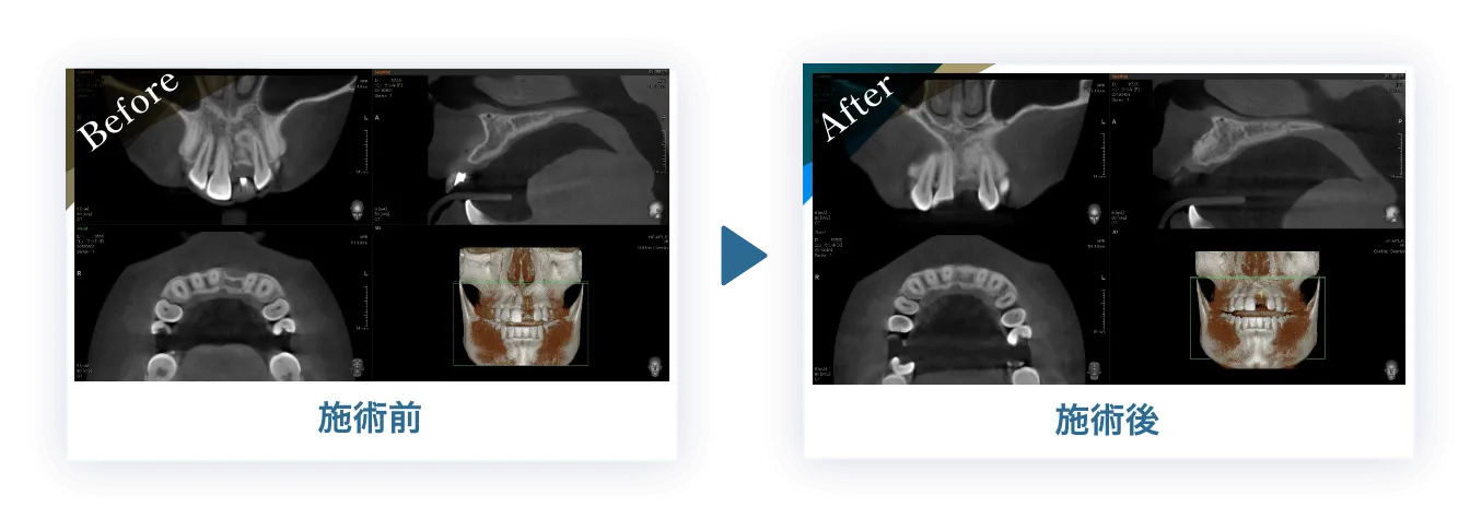 施術後と施術前